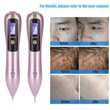 LCD Face Skin Dark Spot Remover Mole