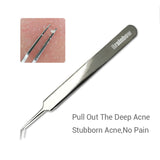 Acne Tweezers Black Head Pimples