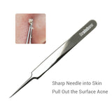 Acne Tweezers Black Head Pimples