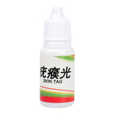 Body Warts Corn Mole Genital Wart Treatment